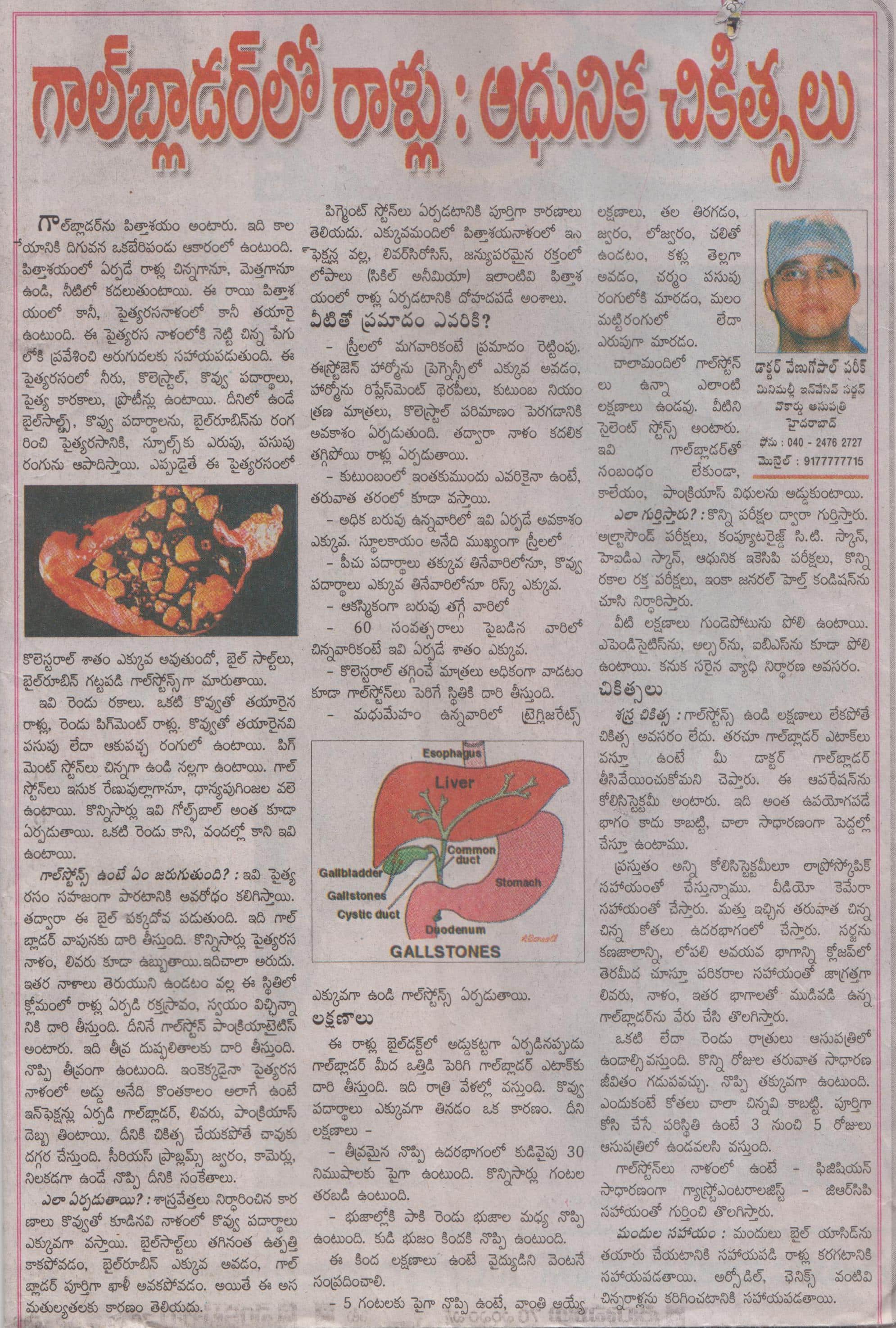 Treatment Gallbladder stones: Explained by Dr V Pareek Laparoscopic GI surgeon Hyderabad