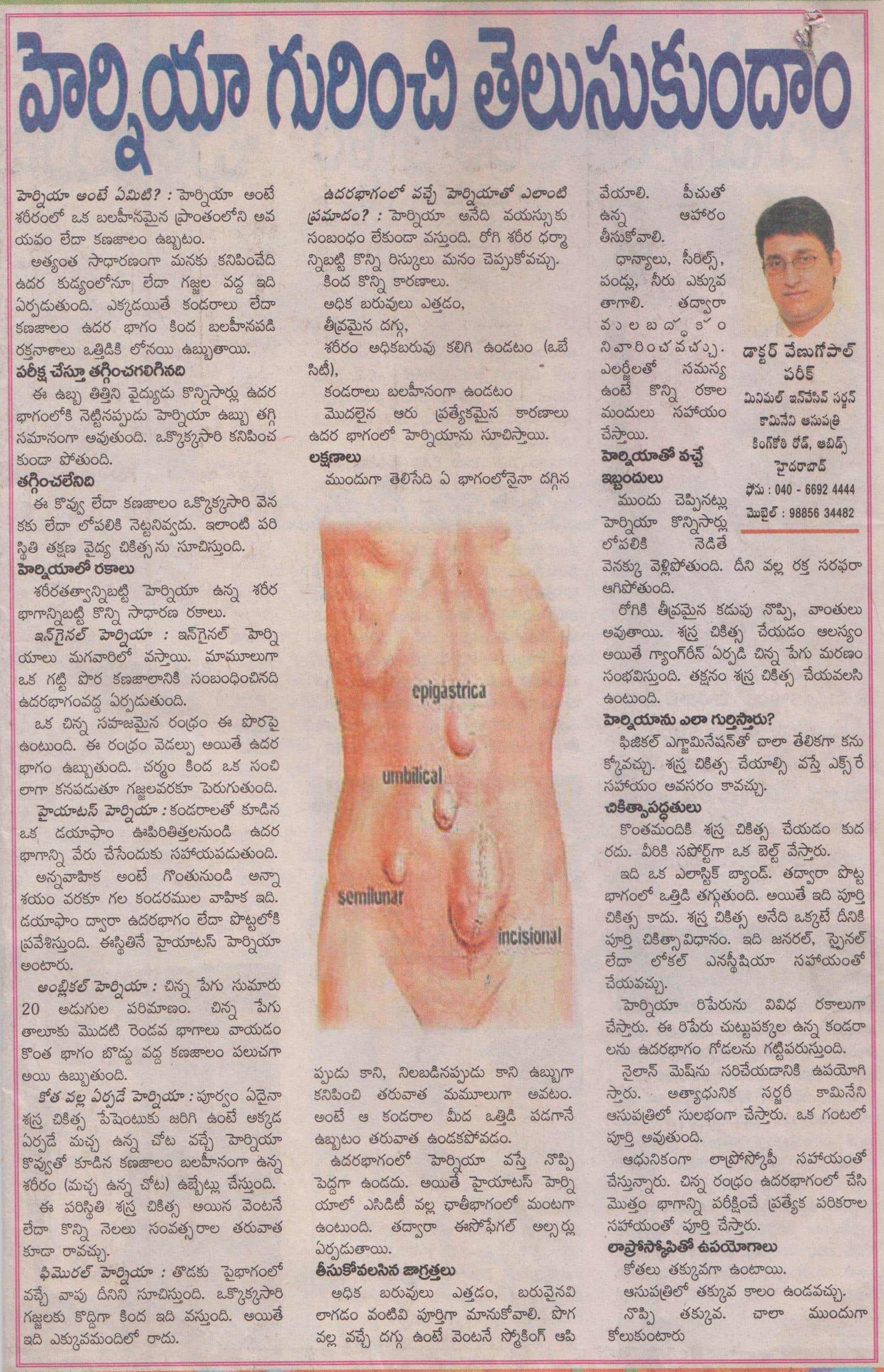 What you should know about Hernia and Treatment: explained by Dr Venugopal Pareek, Best hernia specialist in Hyderabad