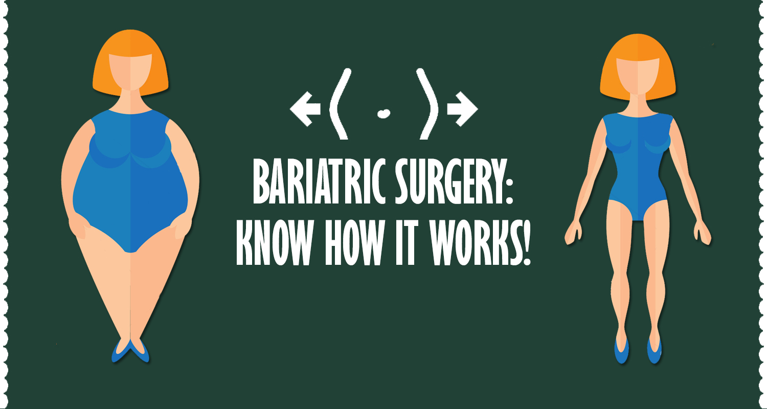 How Will Bariatric Surgery Help Me Lose Weight?