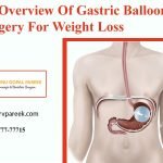 Gastric Balloon Surgery For Weight Loss in Hyderabad, weight decrease hospital near me