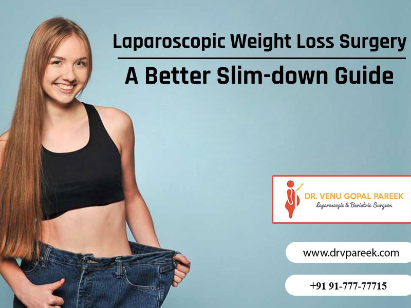 Consult Dr. Venugopal Pareek for Laparoscopic weight loss surgery slim down guide, weight reduction surgery clinic near me