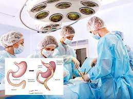 The best doctors for Laparoscopic Bariatric Surgery in Hyderabad, weight loss surgery specialists near me