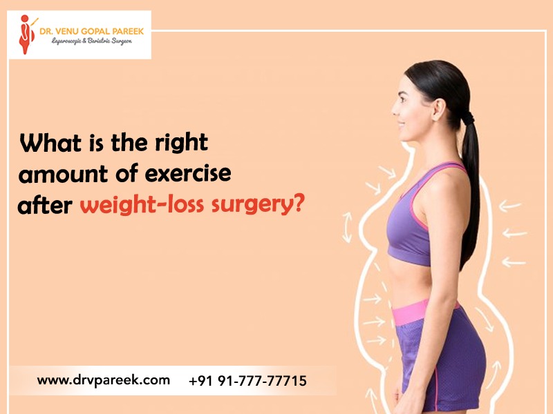 What is the right amount of exercise after weight-loss surgery? - Bariatric  Surgeon India
