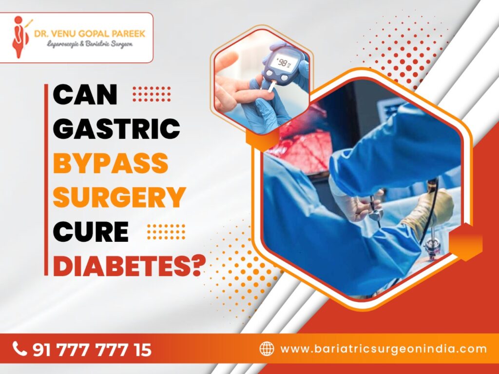 Can Gastric Bypass Surgery cure Diabetes ? Bariatric Surgeon India