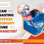 Can gastric bypass surgery cure diabetes