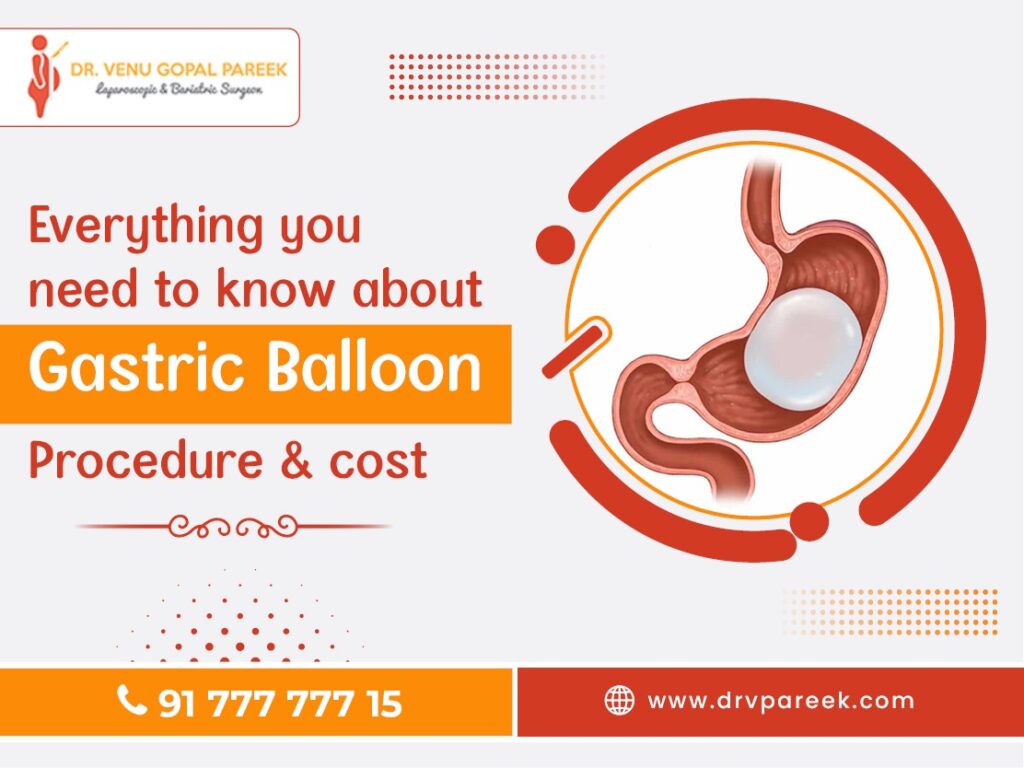 Everything you need to know about Gastric Balloon Procedure & Cost