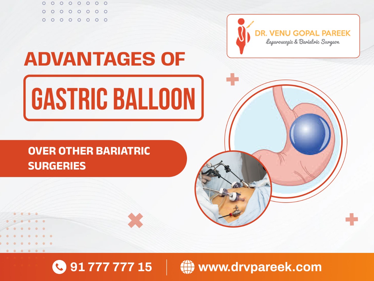 advantages of gastric ballon over other bariatric surgeries