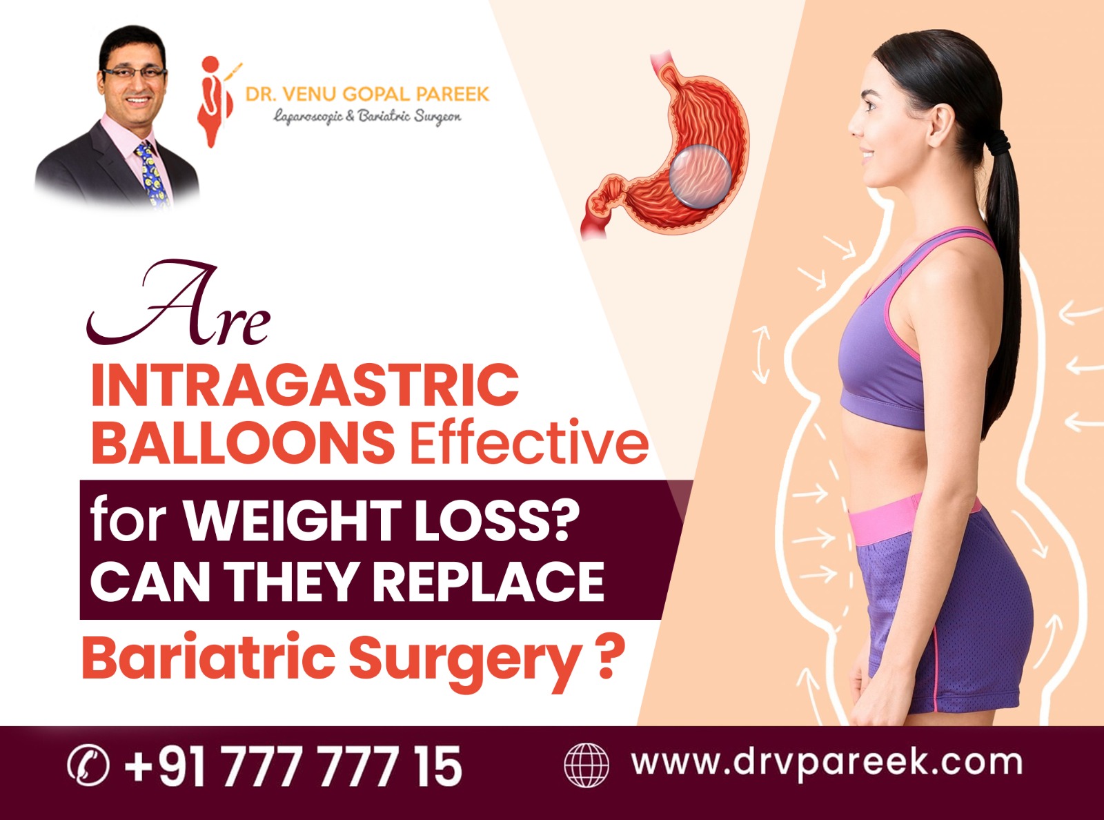 Are intragastric balloons effective for weight loss? Can they